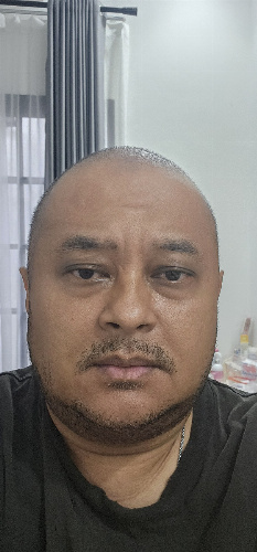 101
